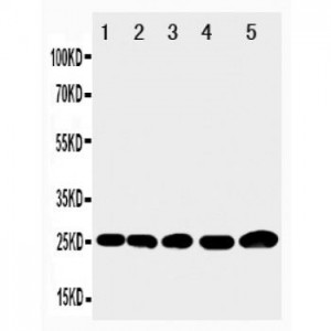 IGFBP6 Antibody