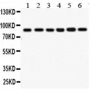 IKK beta Antibody