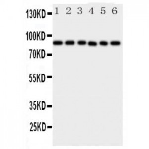 IKK beta Antibody