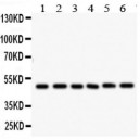 IKK gamma Antibody