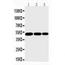 IKK gamma Antibody