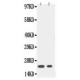 IL1 beta Antibody