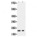 IL1 beta Antibody