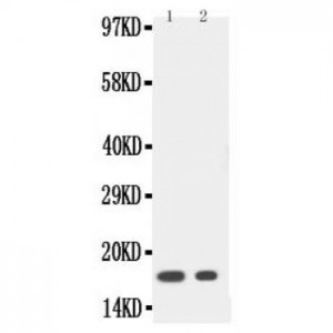 IL1 beta Antibody