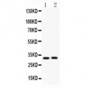 IL1 beta Antibody