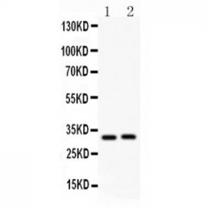 IL1 beta Antibody