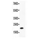 IL12 p40 Antibody