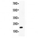 IL12 p40 Antibody