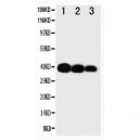 IL12 p40 Antibody