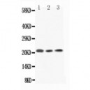 IL18  Antibody