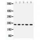 IL2  Antibody