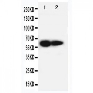 IL2 Receptor beta Antibody