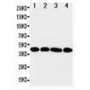 IL3RA Antibody