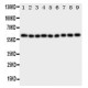 IL5RA Antibody