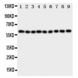 IL5RA Antibody