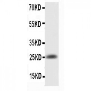 IL6  Antibody