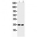 IL6  Antibody