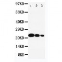 IL6 Antibody