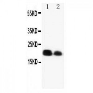 IL-6 Antibody