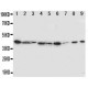 Indoleamine 2, 3-dioxygenase Antibody