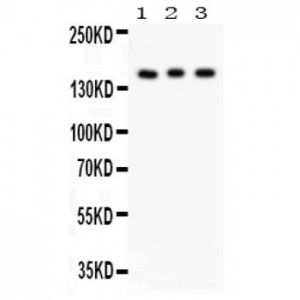 Insulin Receptor Antibody