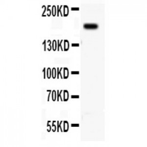 Integrin beta 4 Antibody