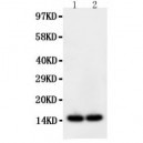 intestinal FABP Antibody