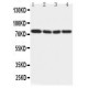 IRAK Antibody