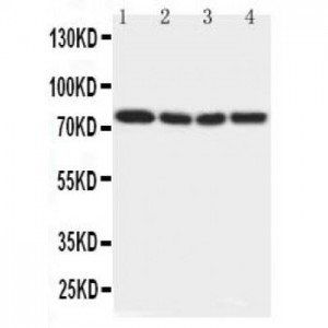 IRAK Antibody