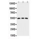 IRAK4 Antibody