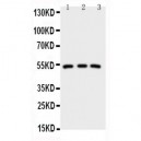 IRAK4 Antibody