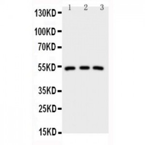 IRAK4 Antibody