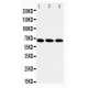 IRAKM Antibody