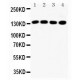 IRS1 Antibody