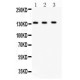 JAK1 Antibody