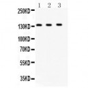 JAK1 Antibody