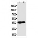 Kallikrein 9 Antibody