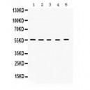 KCNA3  Antibody