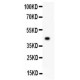 KCNH2  Antibody