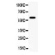 KCNN4 Antibody