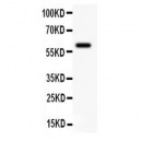 KCNN4 Antibody