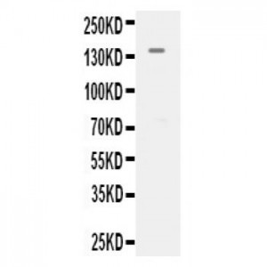 KDR  Antibody