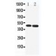 5HT1A Receptor Antibody