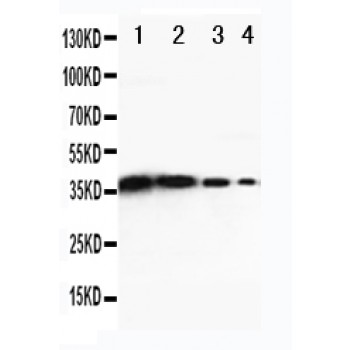 DDX6 Antibody - Novatein Biosciences