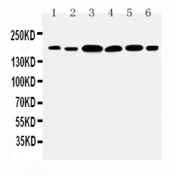 Laminin Gamma 1 Antibody - Novatein Biosciences