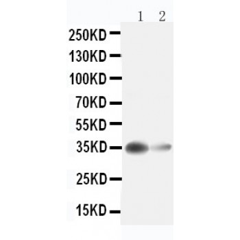 Liver Arginase Antibody - Novatein Biosciences